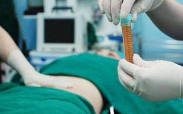 處女膜閉鎖修復(fù)的適應(yīng)癥及手術(shù)過程