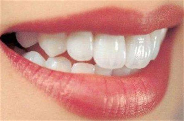 牙齒貼面修復(fù)的效果可以維持多長(zhǎng)時(shí)間