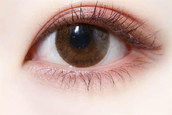 上海重瞼術(shù)的費用要多少