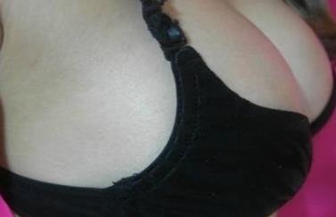 詳解什么是巨乳癥