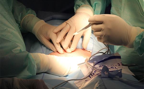 <a href=http://m.f3bb6.cn/listinfo-724-0.html target=_blank class=infotextkey>雙眼皮</a>埋線拆除能恢復(fù)嗎