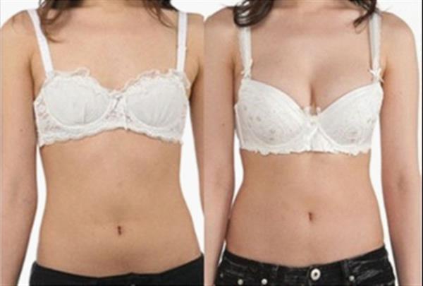 <a href=http://m.f3bb6.cn/listinfo-618-0.html target=_blank class=infotextkey>隆胸</a>后能母乳嗎