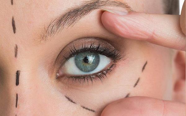 埋線對眼睛有傷害嗎