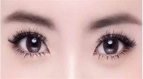 <a href=http://m.f3bb6.cn/listinfo-724-0.html target=_blank class=infotextkey>雙眼皮</a>變單眼皮可以通過哪些手術(shù)方式