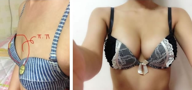 乳房整形前后對比