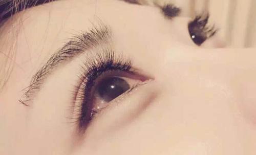 全切<a href=http://m.f3bb6.cn/listinfo-724-0.html target=_blank class=infotextkey>雙眼皮</a>手術(shù)的恢復(fù)時間