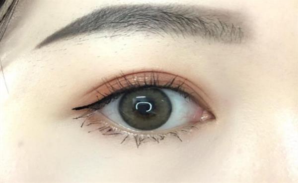 多眼皮怎么變回<a href=http://m.f3bb6.cn/listinfo-724-0.html target=_blank class=infotextkey>雙眼皮</a>的方法有哪些