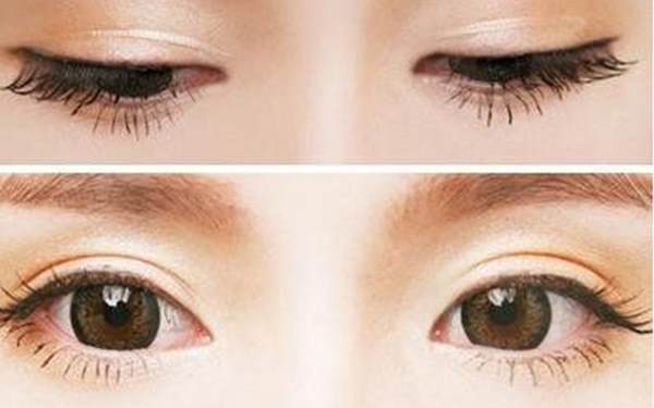 例假期間能割<a href=http://m.f3bb6.cn/listinfo-724-0.html target=_blank class=infotextkey>雙眼皮</a>嗎