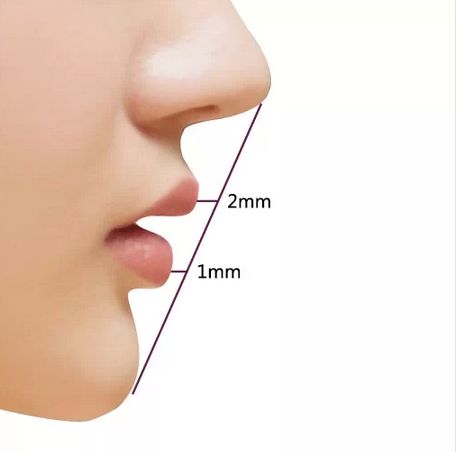 鼻子整形失敗照片