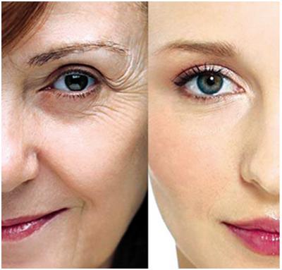 注射botox<a href=http://m.f3bb6.cn/listinfo-614-0.html target=_blank class=infotextkey>除皺</a>瘦型素<a href=http://m.f3bb6.cn/listinfo-614-0.html target=_blank class=infotextkey>除皺</a>瘦型素<a href=http://m.f3bb6.cn/listinfo-614-0.html target=_blank class=infotextkey>除皺</a>安全嗎