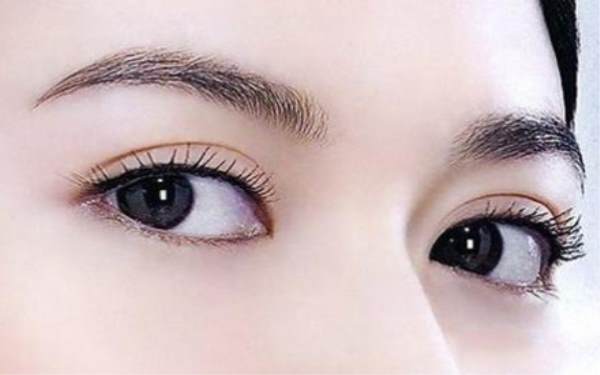 埋線一般多少錢