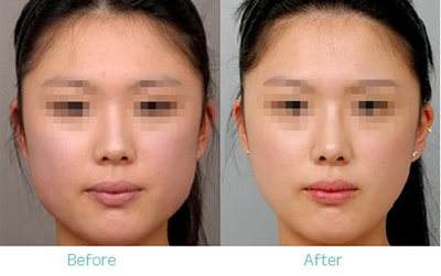 怎樣<a href=http://m.f3bb6.cn/listinfo-631-0.html target=_blank class=infotextkey>瘦臉</a>加快