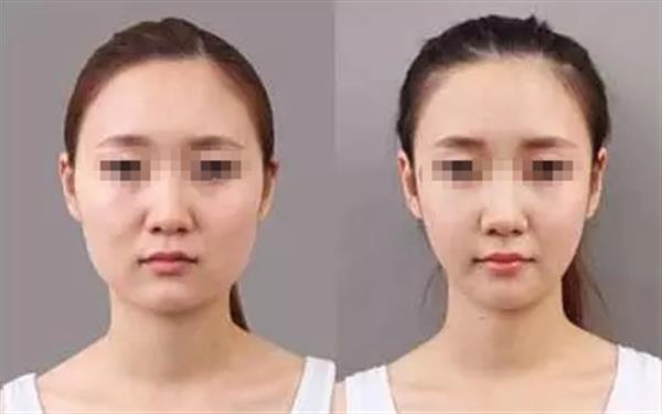 <a href=http://m.f3bb6.cn/listinfo-685-0.html target=_blank class=infotextkey>吸脂</a><a href=http://m.f3bb6.cn/listinfo-631-0.html target=_blank class=infotextkey>瘦臉</a>的操作方式及風險