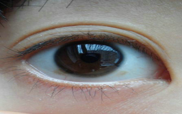 切割<a href=http://m.f3bb6.cn/listinfo-724-0.html target=_blank class=infotextkey>雙眼皮</a>幾天能洗澡?