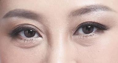 涂什么可以<a href=http://m.f3bb6.cn/listinfo-708-0.html target=_blank class=infotextkey>去眼袋</a>