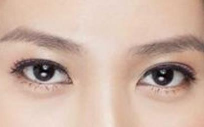 怎樣<a href=http://m.f3bb6.cn/listinfo-708-0.html target=_blank class=infotextkey>去眼袋</a>和皺紋