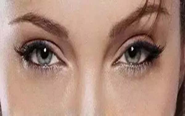 一般<a href=http://m.f3bb6.cn/listinfo-708-0.html target=_blank class=infotextkey>去眼袋</a>手術多少錢