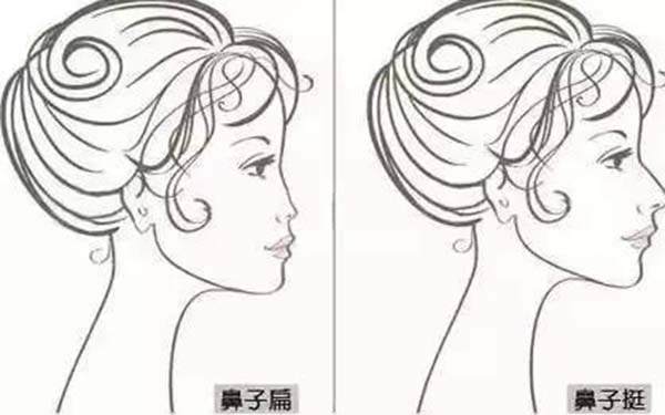 肋骨鼻部多項多久恢復