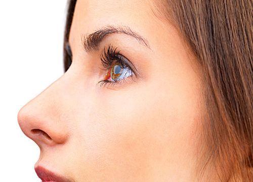 全切<a href=http://m.f3bb6.cn/listinfo-724-0.html target=_blank class=infotextkey>雙眼皮</a>過窄如何修復？