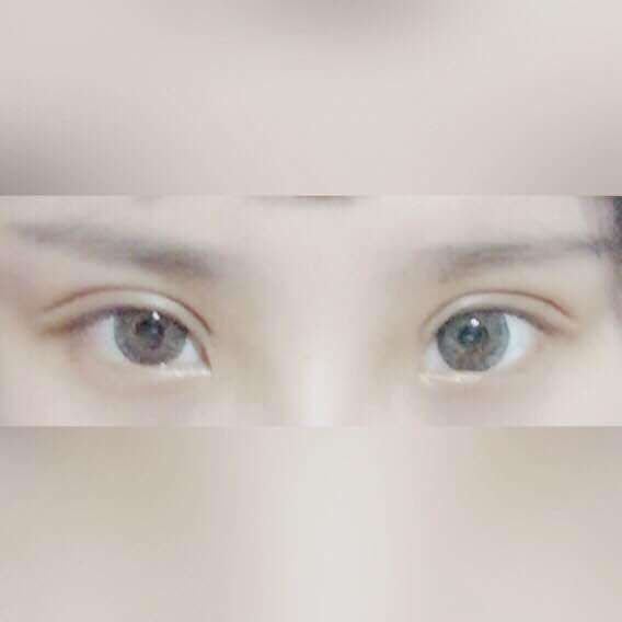 割<a href=http://m.f3bb6.cn/listinfo-724-0.html target=_blank class=infotextkey>雙眼皮</a>15天能化妝嗎