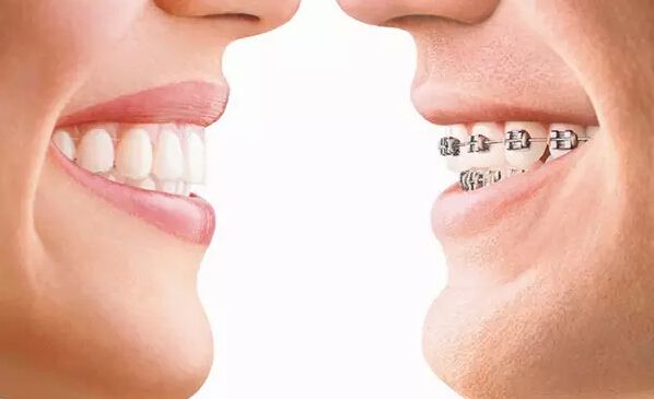 <a href=http://m.f3bb6.cn/listinfo-824-0.html target=_blank class=infotextkey>牙齒矯正</a>前后對比圖