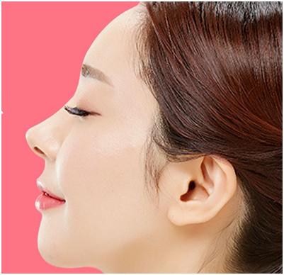 假體<a href=http://m.f3bb6.cn/listinfo-737-0.html target=_blank class=infotextkey>隆鼻</a>多久能恢復(fù)好