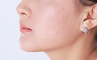 人<a href=http://m.f3bb6.cn/listinfo-631-0.html target=_blank class=infotextkey>瘦臉</a>胖如何做