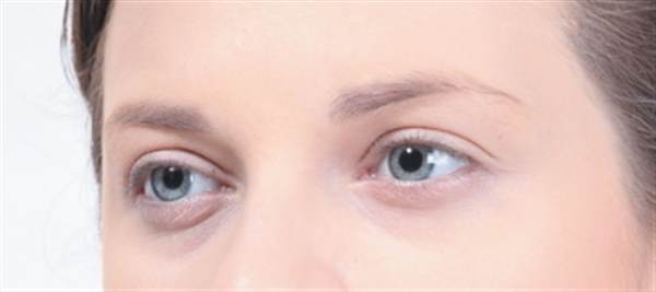 <a href=http://m.f3bb6.cn/listinfo-708-0.html target=_blank class=infotextkey>去眼袋</a>的手術方式都有哪些