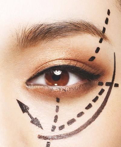 割<a href=http://m.f3bb6.cn/listinfo-724-0.html target=_blank class=infotextkey>雙眼皮</a>會引起臉腫嗎