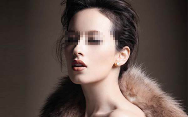 面部肥胖的癥狀及<a href=http://m.f3bb6.cn/listinfo-685-0.html target=_blank class=infotextkey>吸脂</a><a href=http://m.f3bb6.cn/listinfo-631-0.html target=_blank class=infotextkey>瘦臉</a>效果