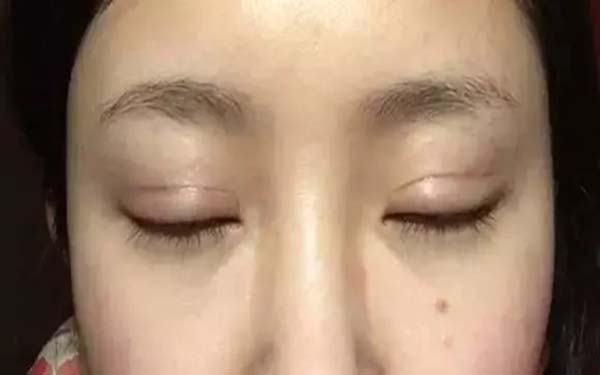 <a href=http://m.f3bb6.cn/listinfo-724-0.html target=_blank class=infotextkey>雙眼皮</a>拆線后多久可以化妝