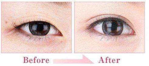 現在割<a href=http://m.f3bb6.cn/listinfo-724-0.html target=_blank class=infotextkey>雙眼皮</a>多久恢復