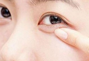 <a href=http://m.f3bb6.cn/listinfo-724-0.html target=_blank class=infotextkey>雙眼皮</a>埋線手術安全性好嗎