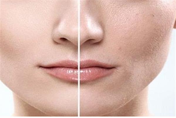 面部皮膚下垂可以恢復(fù)嗎