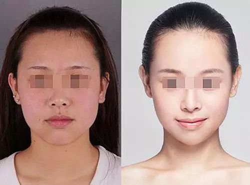 衡力<a href=http://m.f3bb6.cn/listinfo-631-0.html target=_blank class=infotextkey>瘦臉</a><a href=http://m.f3bb6.cn/listinfo-614-0.html target=_blank class=infotextkey>除皺</a>多久出效果