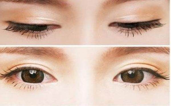 韓美切<a href=http://m.f3bb6.cn/listinfo-724-0.html target=_blank class=infotextkey>雙眼皮</a>多少錢