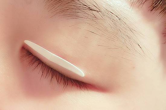 <a href=http://m.f3bb6.cn/listinfo-724-0.html target=_blank class=infotextkey>雙眼皮</a>埋線手術費用大致大致是多少