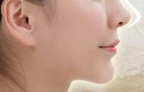 假體<a href=http://m.f3bb6.cn/listinfo-737-0.html target=_blank class=infotextkey>隆鼻</a>注意事項